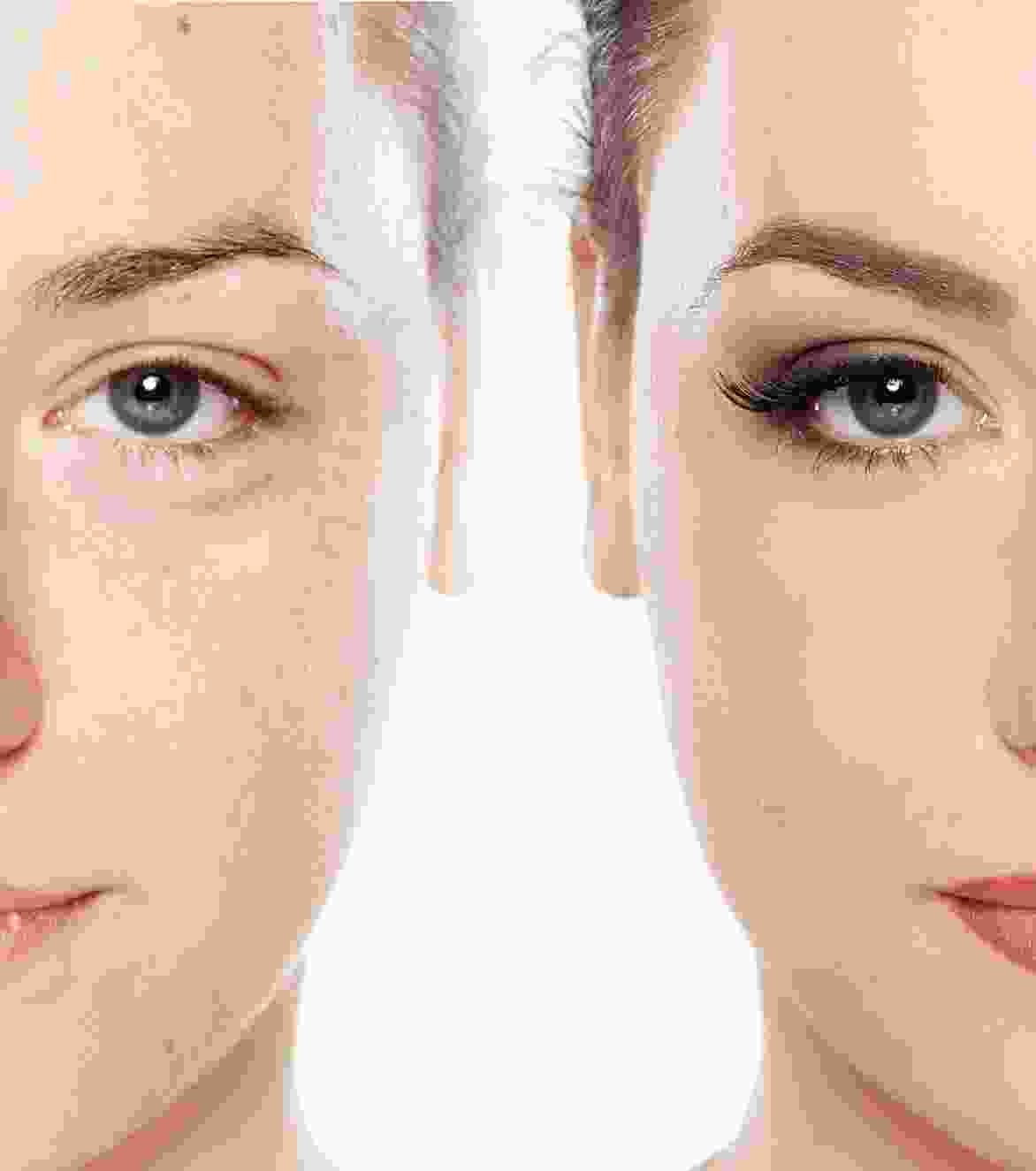 Hair Transplantation Hair Transplantation